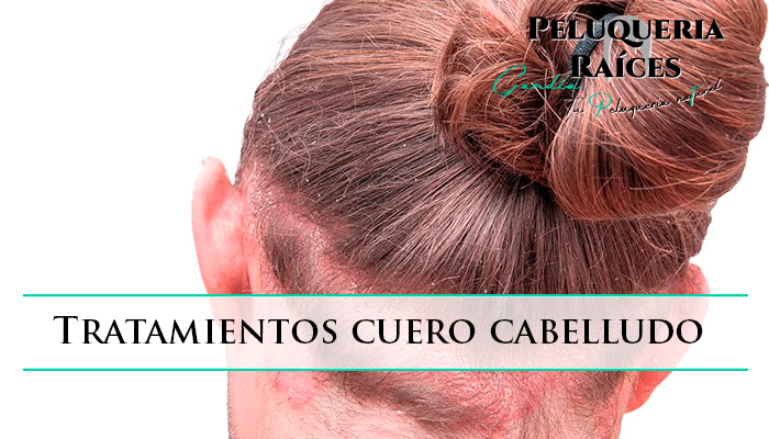tratamientos-cuero-cabelludo